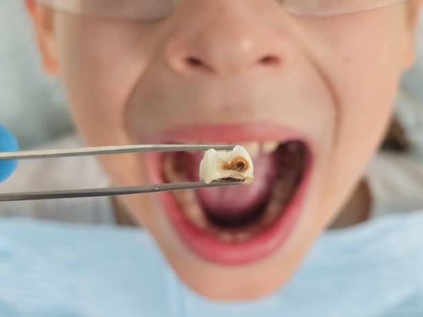 Best Emergency Dental Care for Trauma or Injury in Manahawkin, NJ